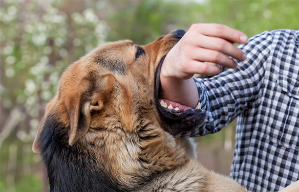 Dog Bite